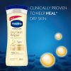 لوسیون بدن وازلین عصاره جو دوسر Vaseline مدل DRY SKIN REPAIR - Image 2