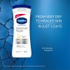 لوسیون بدن ترمیم کننده وازلین Vaseline مدل Advanced Repair - Image 2
